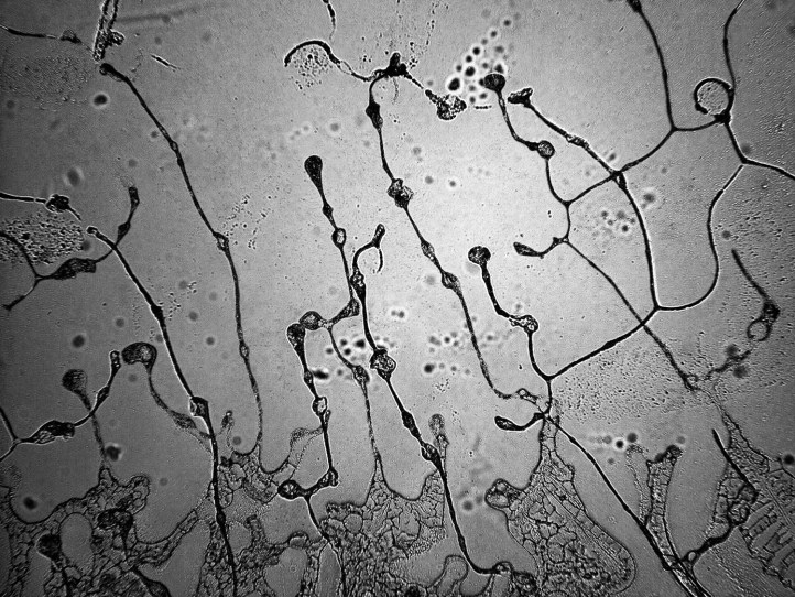 Suze žudnje za slobodom